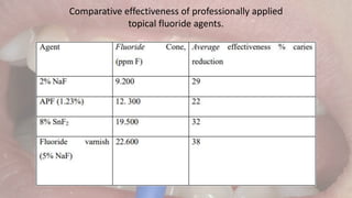 Comparative effectiveness of professionally applied
topical fluoride agents.
 