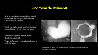 Triada Rigeler Fluroscopia del duodeno.pptx