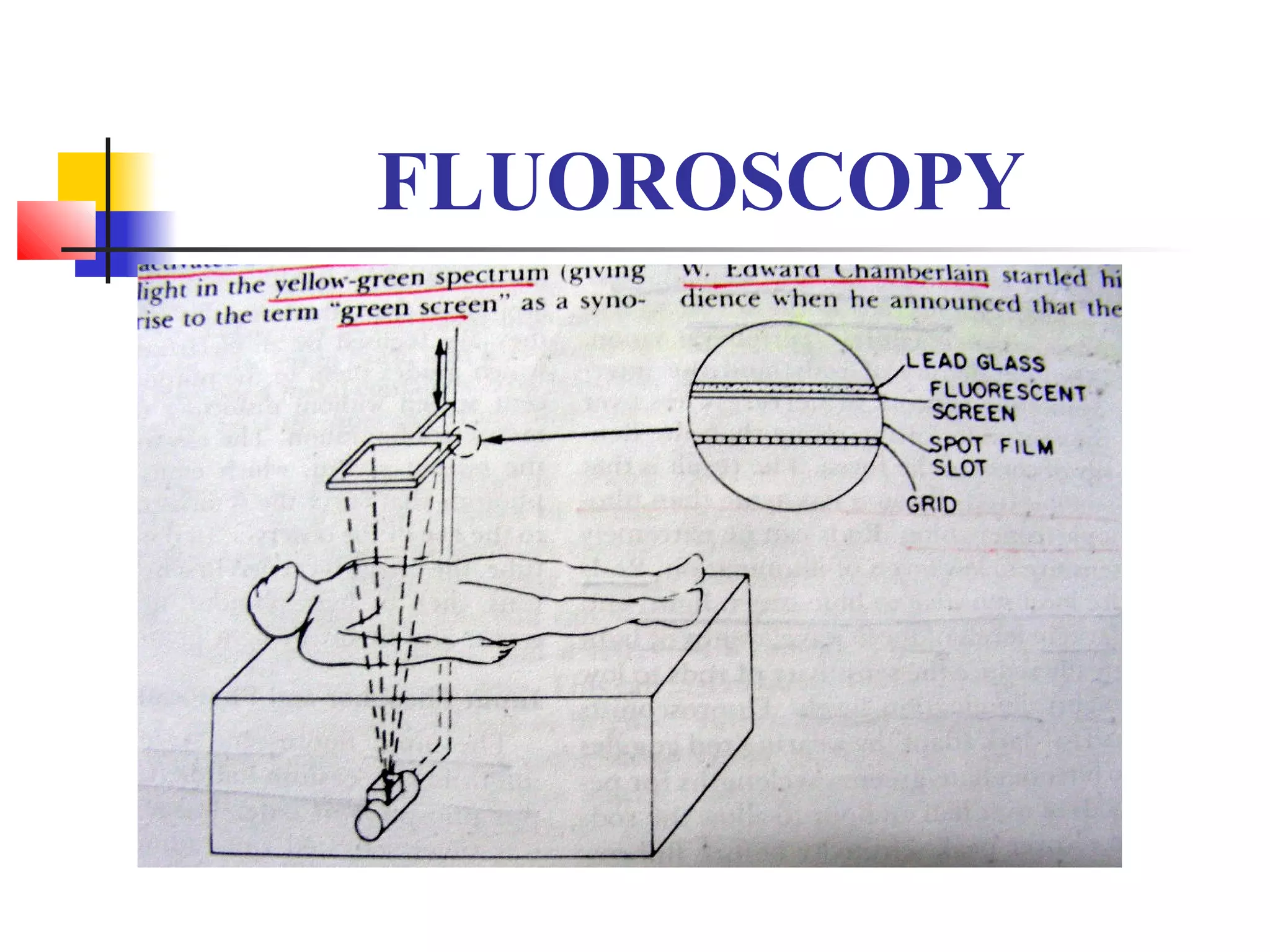 FLUOROSCOPY 
 