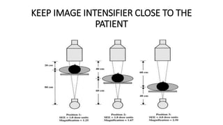 KEEP IMAGE INTENSIFIER CLOSE TO THE
PATIENT
 