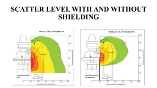 SCATTER LEVEL WITH AND WITHOUT
SHIELDING
 