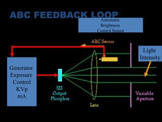 ABC FEEDBACK LOOP 
Generator 
Exposure 
Control 
KVp 
mA 
Automatic 
Brightness 
Control Sensor 
Light 
Intensity 
 