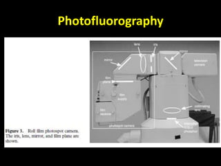 Photofluorography 
 