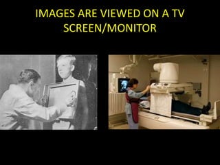 IMAGES ARE VIEWED ON A TV 
SCREEN/MONITOR 
 