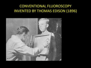 CONVENTIONAL FLUOROSCOPY 
INVENTED BY THOMAS EDISON (1896) 
 