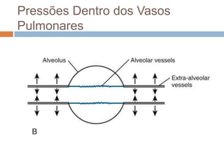 Pressões Dentro dos Vasos PulmonaresO comportamento dos capilares e dos vasos sanguíneos maiores é tão diferente que muitas vezes são referidos como vasos alveolares e extra-alveolares.Alveolar – todos os expostos à pressão alveolar.Seu calibre é determinado pela relação entre a pressão alveolar e a pressão dentro deles.Extra-alveolar: todas as artérias e veias que atravessam o parênquima pulmonar. Seu calibre é muito afetado pelo volume pulmonar, pois o que determina a expansão é a tração do parênquima em suas paredes. 