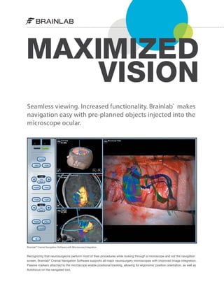 MAXIMIZED
VISION
Seamless viewing. Increased functionality. Brainlab® makes
navigation easy with pre-planned objects injected into the
microscope ocular.

Brainlab ® Cranial Navigation Software with Microscope Integration

Recognizing that neurosurgeons perform most of their procedures while looking through a microscope and not the navigation
screen, Brainlab® Cranial Navigation Software supports all major neurosurgery microscopes with improved image integration.
Passive markers attached to the microscope enable positional tracking, allowing for ergonomic position orientation, as well as
Autofocus on the navigated tool.

 