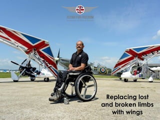 Replacing lost
and broken limbs
with wings
 