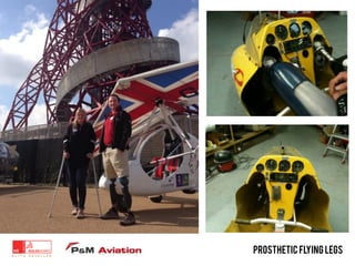 Prosthetic FLYING LEGS
 