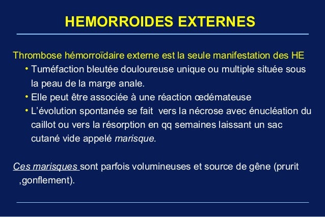 La varice sur les pieds de la raison et les symptômes