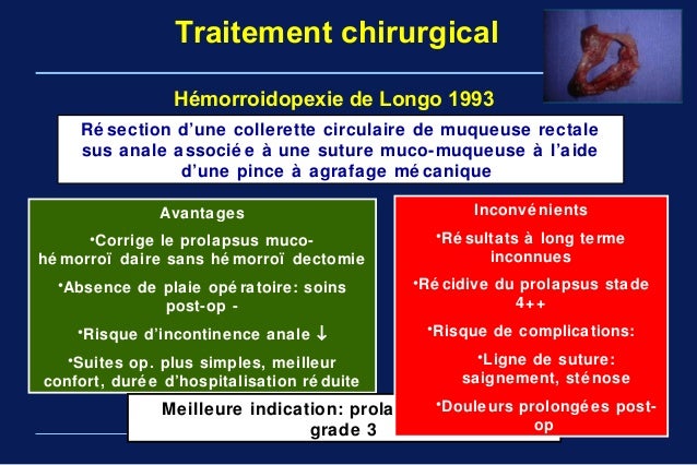 Fmc maladie hemorroidaire Pr Arbaoui fac med tlemcen Fmc maladie hemorroidaire Pr Arbaoui fac med tlemcen