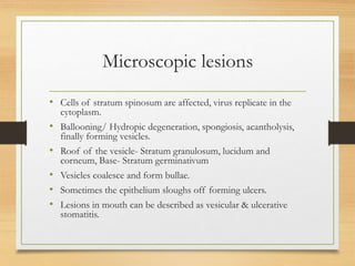 Microscopic lesions
• Cells of stratum spinosum are affected, virus replicate in the
cytoplasm.
• Ballooning/ Hydropic degeneration, spongiosis, acantholysis,
finally forming vesicles.
• Roof of the vesicle- Stratum granulosum, lucidum and
corneum, Base- Stratum germinativum
• Vesicles coalesce and form bullae.
• Sometimes the epithelium sloughs off forming ulcers.
• Lesions in mouth can be described as vesicular & ulcerative
stomatitis.
 