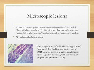 Microscopic lesions
• In young calves- Hyaline degeneration and necrosis of myocardial
fibers with large numbers of infiltrating lymphocytes and a very few
neutrophils – Mononuclear/lymphocytic and necrotizing myocarditis
• No inclusion body formation.
Microscopic image of calf ’s heart (“tiger-heart”)
from a calf that died from an acute form of
FMD, showing severely affected muscle fibers
with coagulative necrosis), with infiltration of
lymphocytes. (PAS stain, 600x)
 