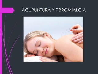 ACUPUNTURA Y FIBROMIALGIA
 