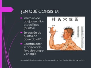 ¿EN QUÉ CONSISTE?
 Inserción de
agujas en sitios
específicos
(puntos)
 Selección de
puntos de
acuerdo al Dx.
 Reestablecer
el adecuado
flujo de sangre
y energía
Maciocia G. The Foundations of Chinese Medicine. 2 ed. Elsevier. 2005. Ch 1-4, pp 1-92.
 