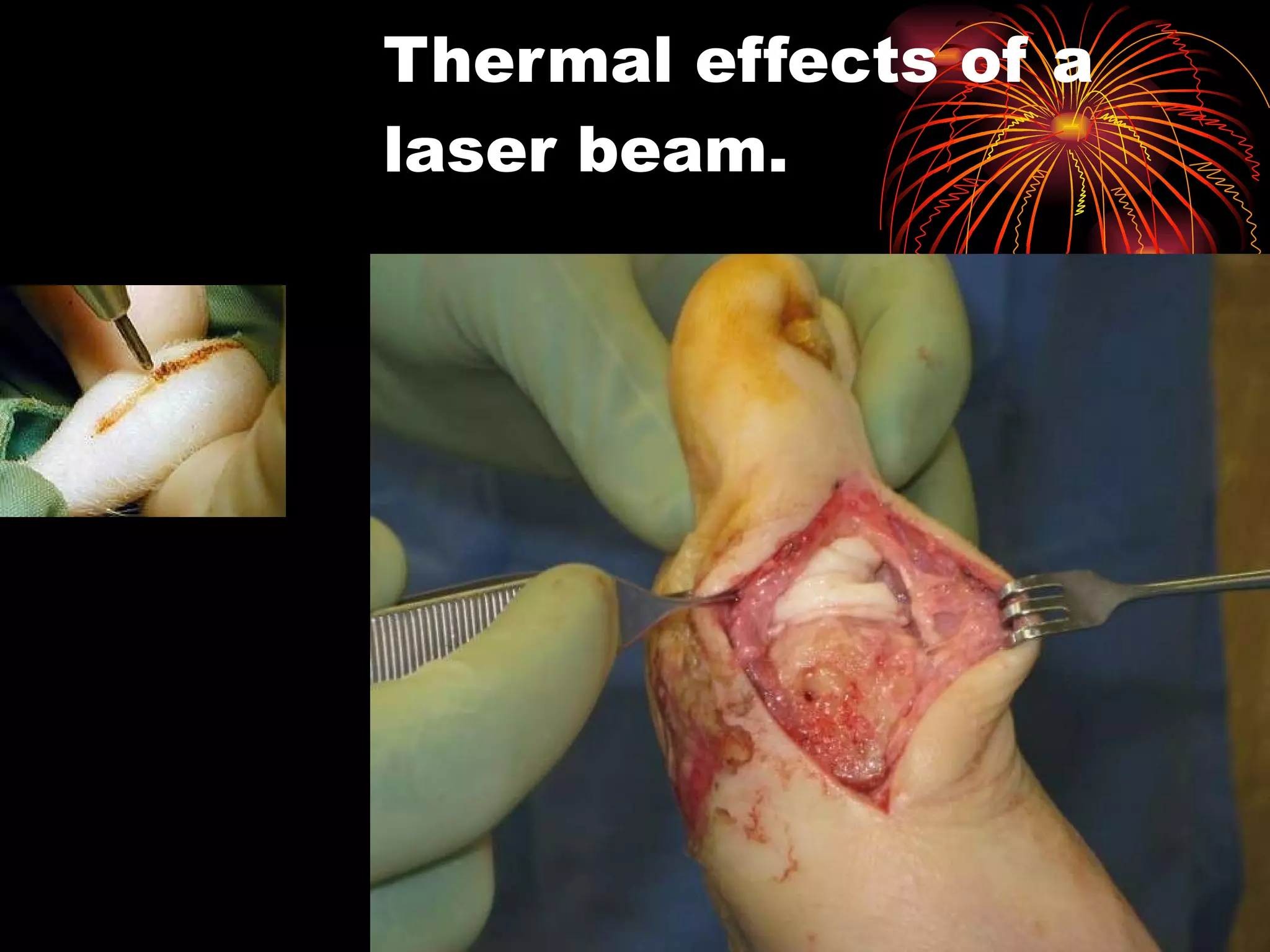 Thermal effects of a  laser beam. 