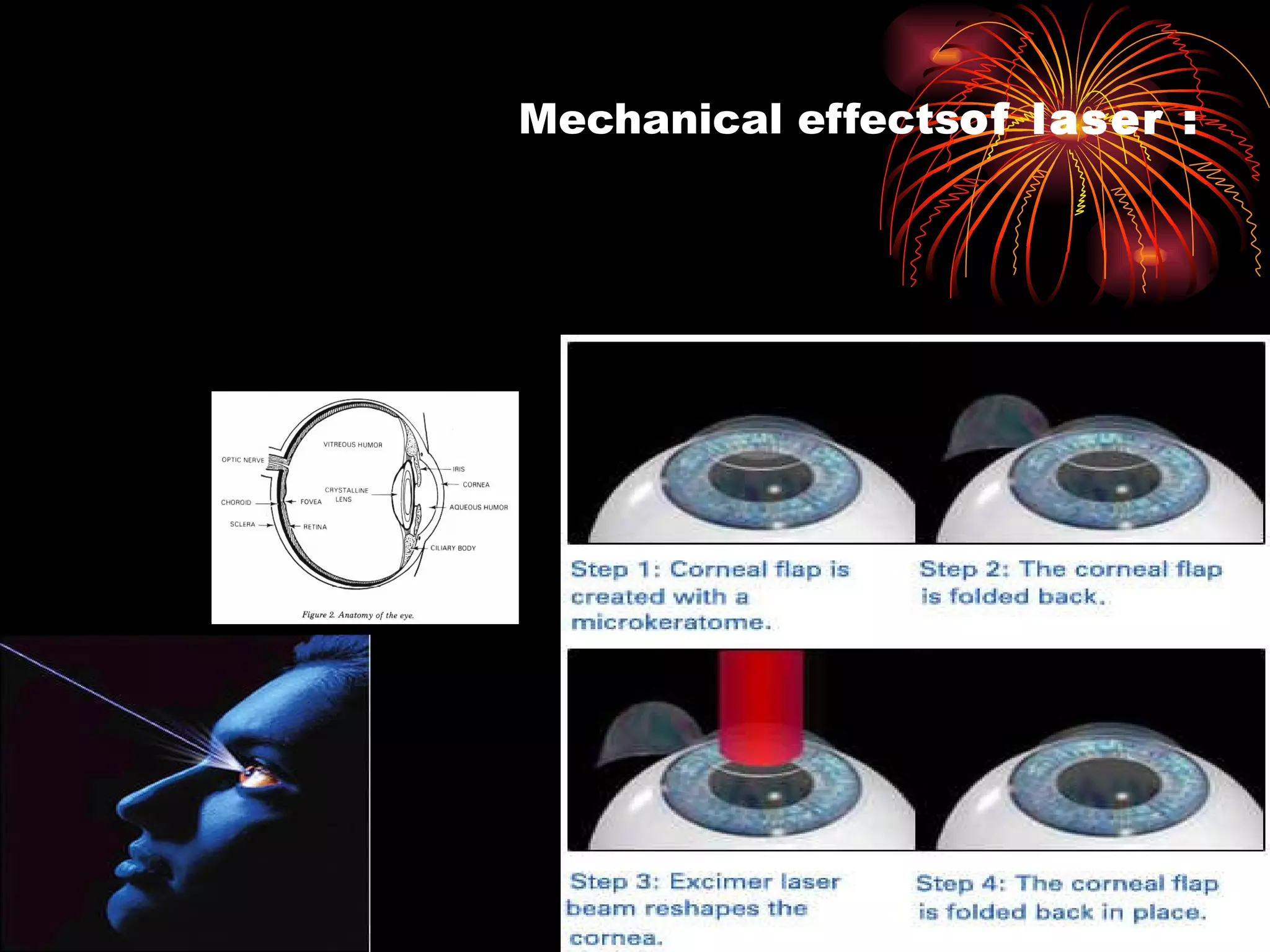 Mechanical effects of laser : 