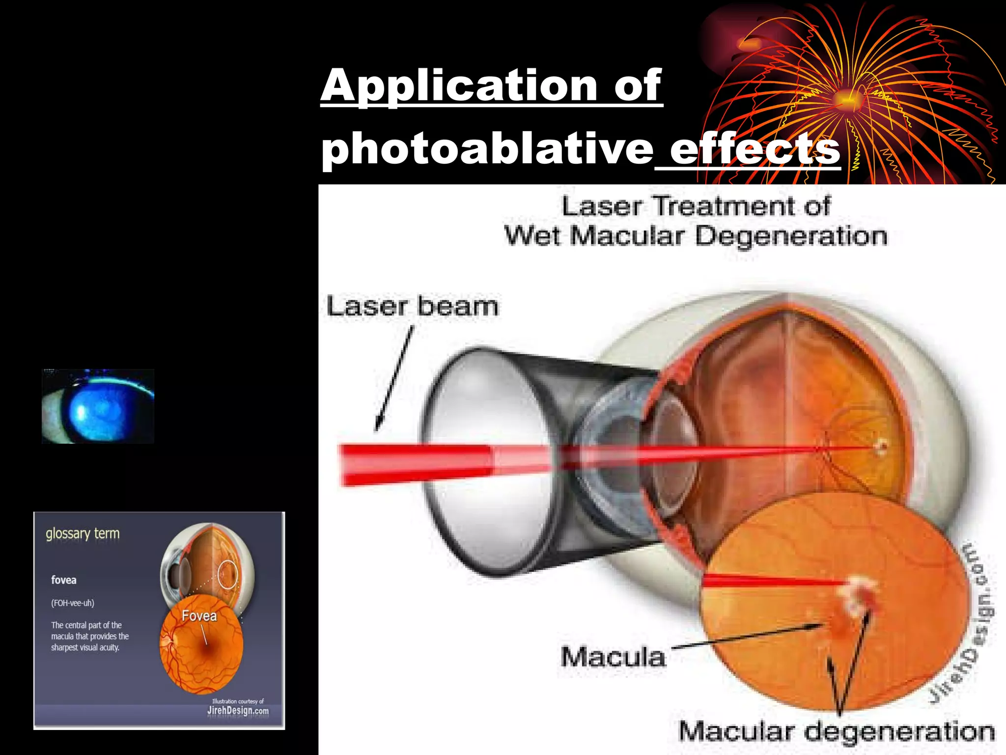 Application of  photoablative  effects 