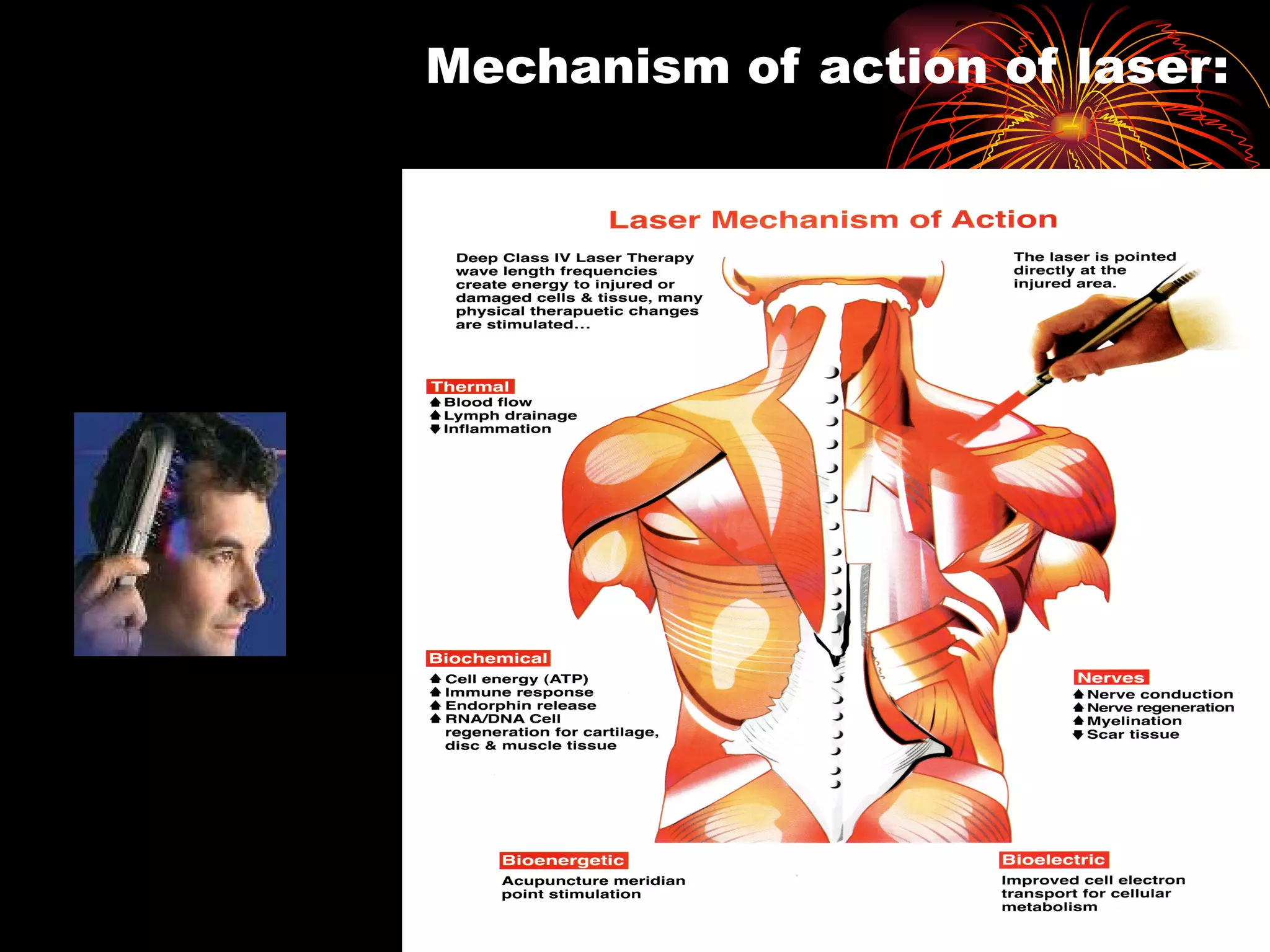 Mechanism of action of laser: 