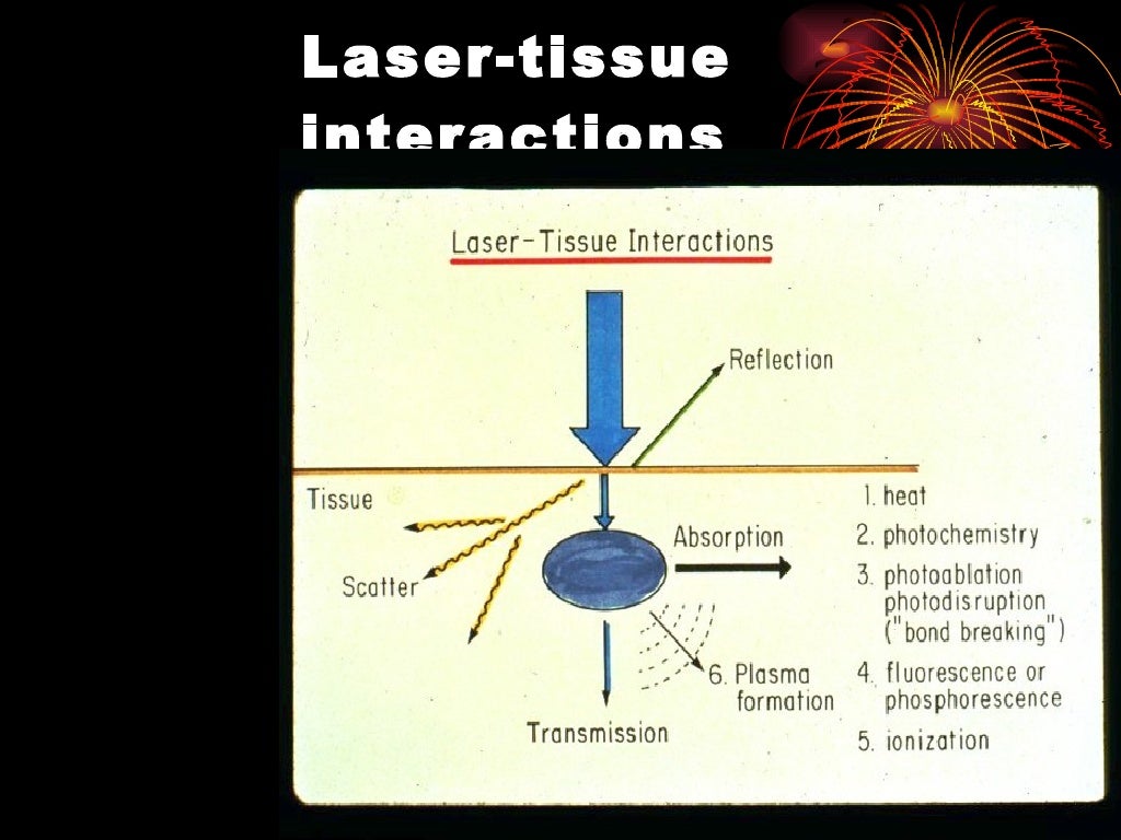Mode of Action of Laser In Tissues