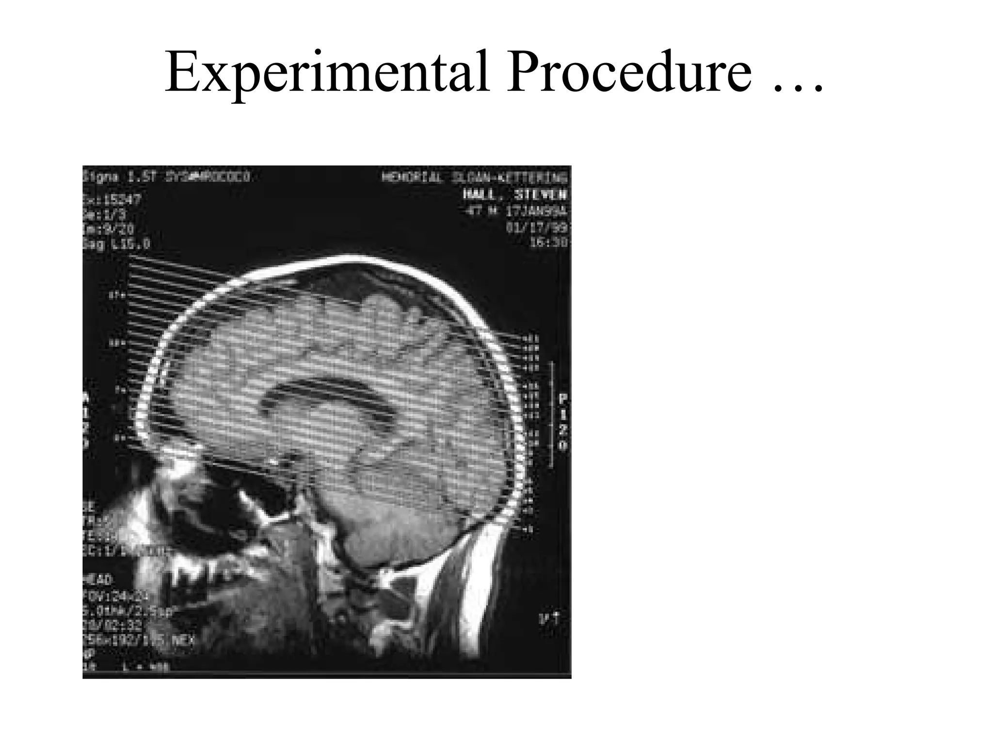 Experimental Procedure … 
