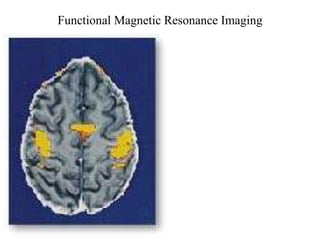 Functional Magnetic Resonance Imaging 