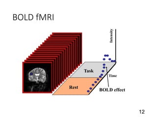 BOLD fMRI
12
Time
Intensity
BOLD effect
 