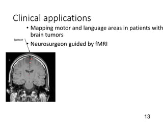 Clinical applications
• Mapping motor and language areas in patients with
brain tumors
• Neurosurgeon guided by fMRI
13
tumor
 