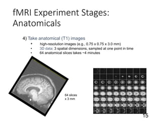 fMRI Experiment Stages:
Anatomicals
15
4) Take anatomical (T1) images
• high-resolution images (e.g., 0.75 x 0.75 x 3.0 mm)
• 3D data: 3 spatial dimensions, sampled at one point in time
• 64 anatomical slices takes ~4 minutes
64 slices
x 3 mm
 