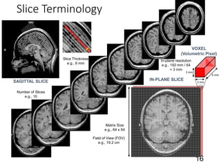 Slice Thickness
e.g., 6 mm
Number of Slices
e.g., 10
SAGITTAL SLICE IN-PLANE SLICE
Field of View (FOV)
e.g., 19.2 cm
VOXEL
(Volumetric Pixel)
3 mm
3 mm
6 mm
Slice Terminology
16
Matrix Size
e.g., 64 x 64
In-plane resolution
e.g., 192 mm / 64
= 3 mm
 
