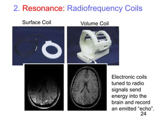Surface Coil Volume Coil
2. Resonance: Radiofrequency Coils
Electronic coils
tuned to radio
signals send
energy into the
brain and record
an emitted “echo”.
24
 