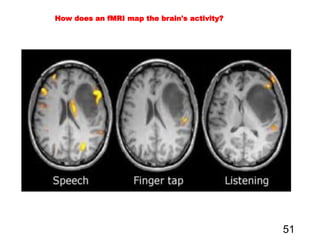 51
How does an fMRI map the brain's activity?
 