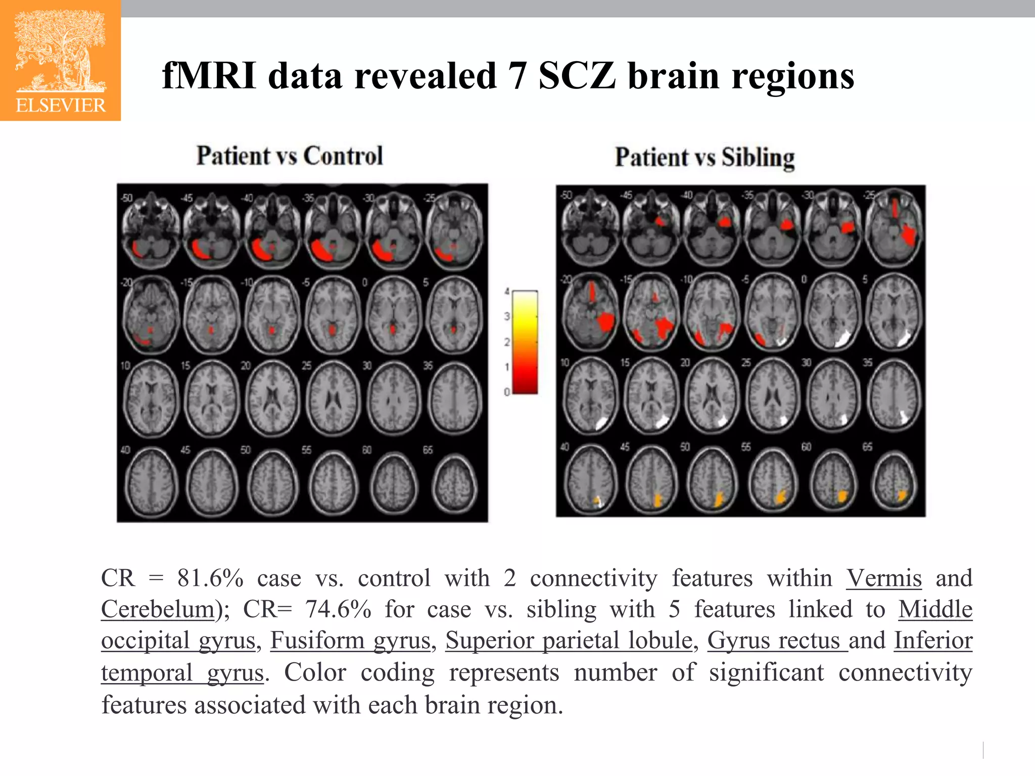 CR = 81.6% case vs. control with 2 connectivity features within Vermis and
Cerebelum); CR= 74.6% for case vs. sibling with 5 features linked to Middle
occipital gyrus, Fusiform gyrus, Superior parietal lobule, Gyrus rectus and Inferior
temporal gyrus. Color coding represents number of significant connectivity
features associated with each brain region.
fMRI data revealed 7 SCZ brain regions
 