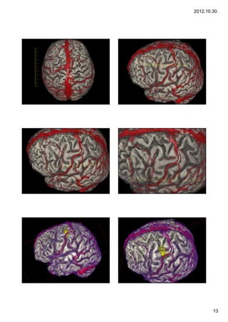 Week 1. Basics of multimodal imaging and image processing. Functional ...