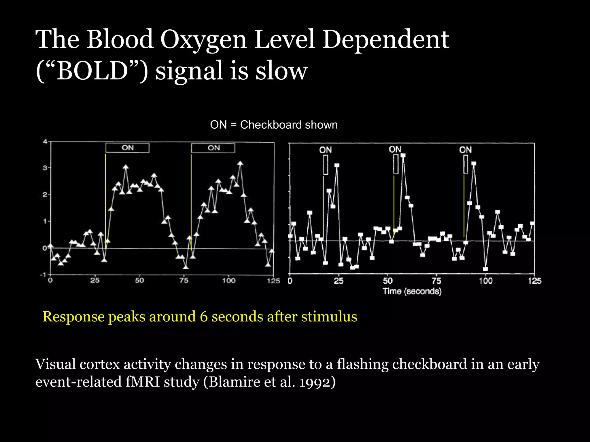 The Blood Oxygen Level Dependent
(“BOLD”) signal is slow
                           ON = Checkboard shown




 Response peaks around 6 seconds after stimulus


Visual cortex activity changes in response to a flashing checkboard in an early
event-related fMRI study (Blamire et al. 1992)
 