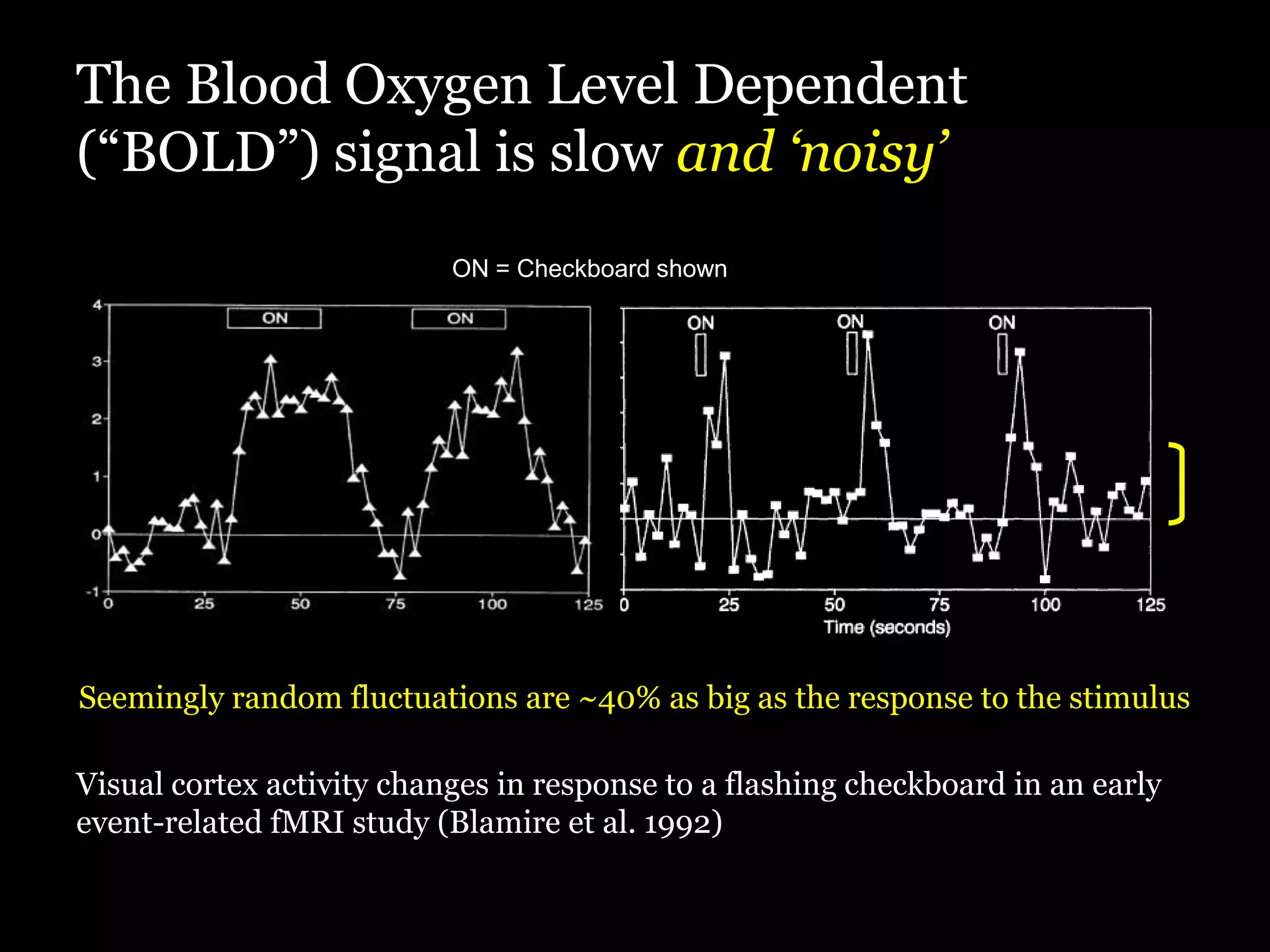 The Blood Oxygen Level Dependent
(“BOLD”) signal is slow and ‘noisy’
                           ON = Checkboard shown




Seemingly random fluctuations are ~40% as big as the response to the stimulus

Visual cortex activity changes in response to a flashing checkboard in an early
event-related fMRI study (Blamire et al. 1992)
 