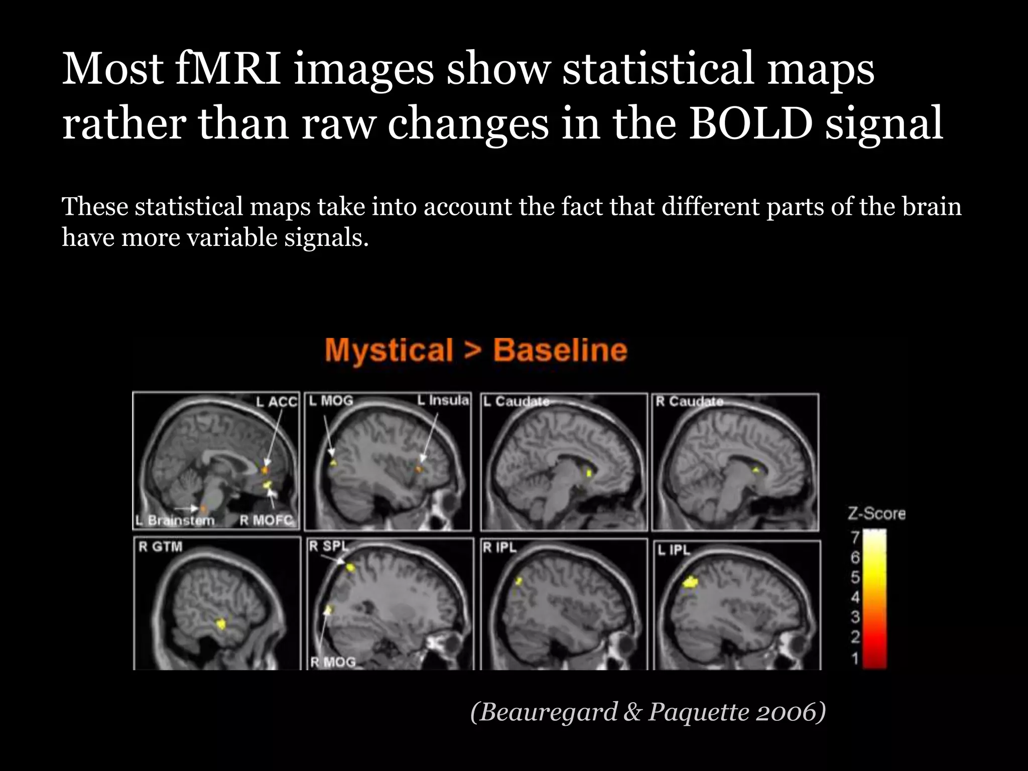 Most fMRI images show statistical maps
rather than raw changes in the BOLD signal
These statistical maps take into account the fact that different parts of the brain
have more variable signals.




                                     (Beauregard & Paquette 2006)
 