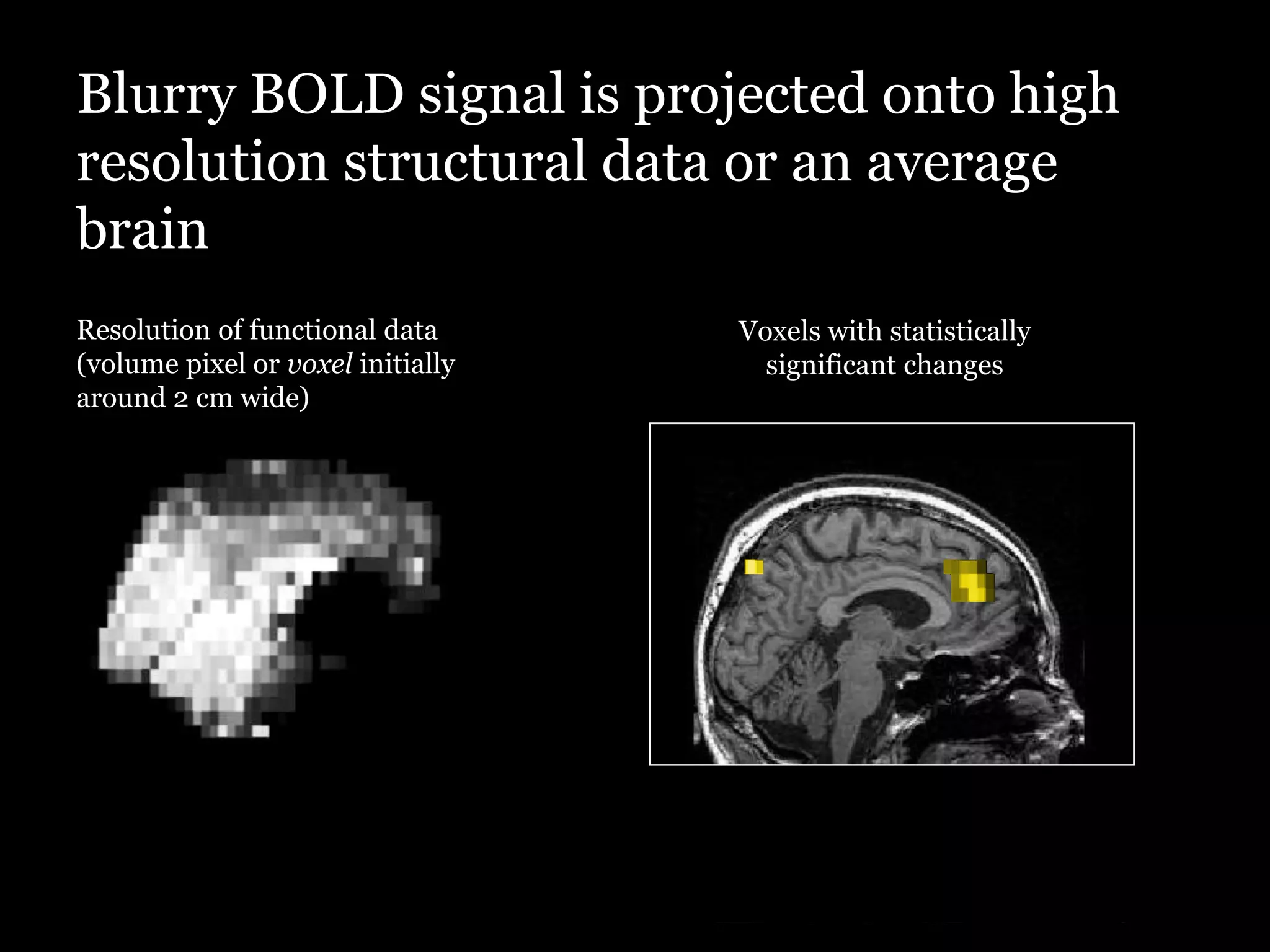 Blurry BOLD signal is projected onto high
resolution structural data or an average
brain
Resolution of functional data      Voxels with statistically
(volume pixel or voxel initially     significant changes
around 2 cm wide)
 