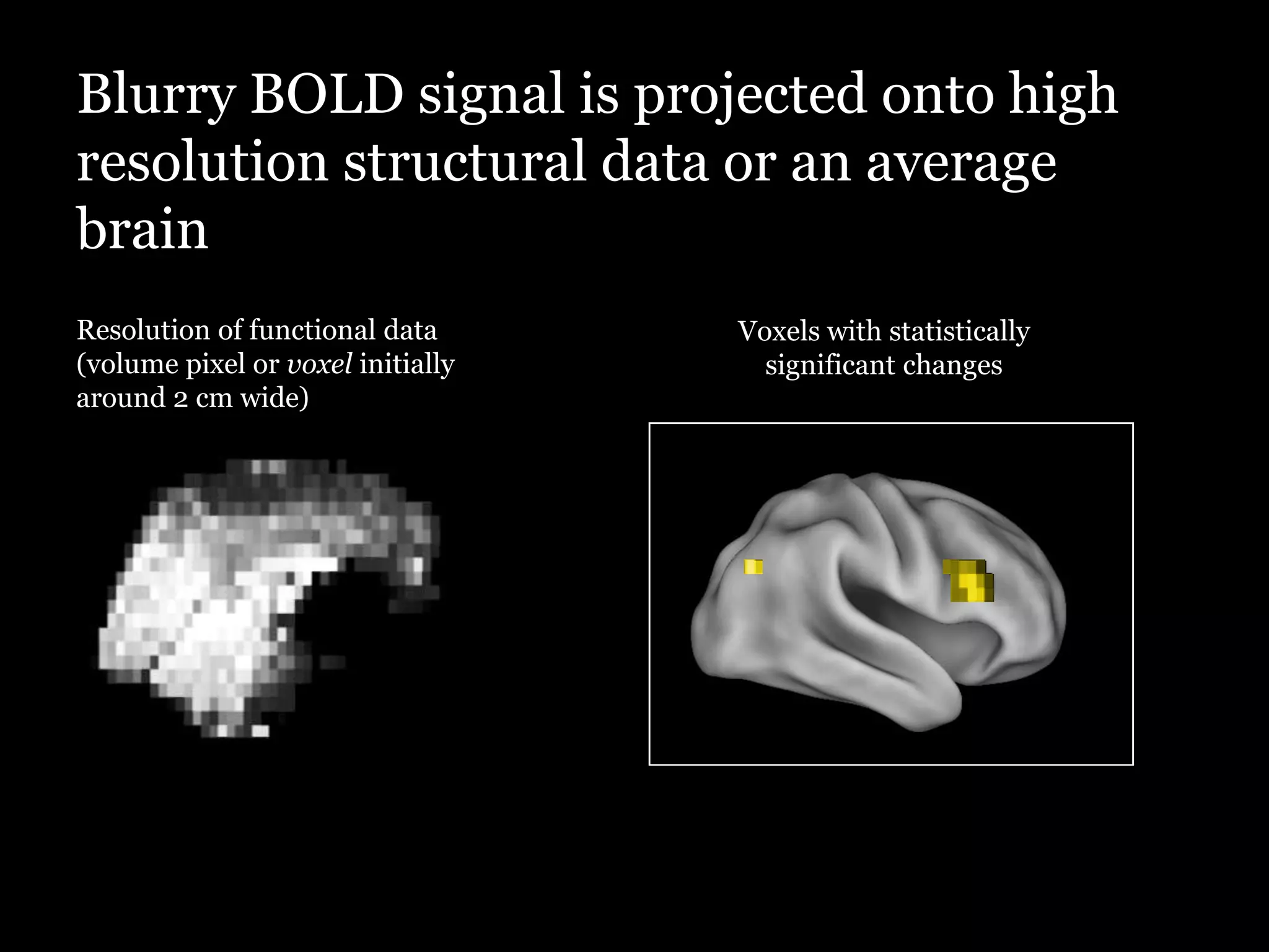 Blurry BOLD signal is projected onto high
resolution structural data or an average
brain
Resolution of functional data      Voxels with statistically
(volume pixel or voxel initially     significant changes
around 2 cm wide)
 