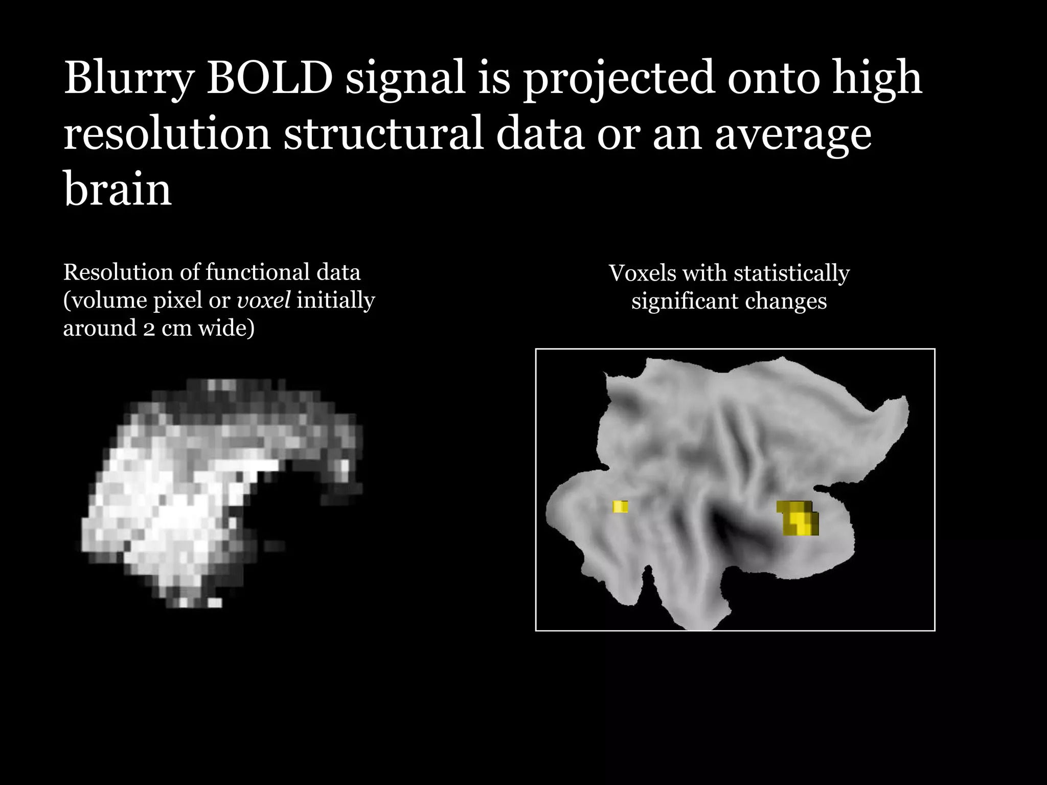 Blurry BOLD signal is projected onto high
resolution structural data or an average
brain
Resolution of functional data      Voxels with statistically
(volume pixel or voxel initially     significant changes
around 2 cm wide)
 