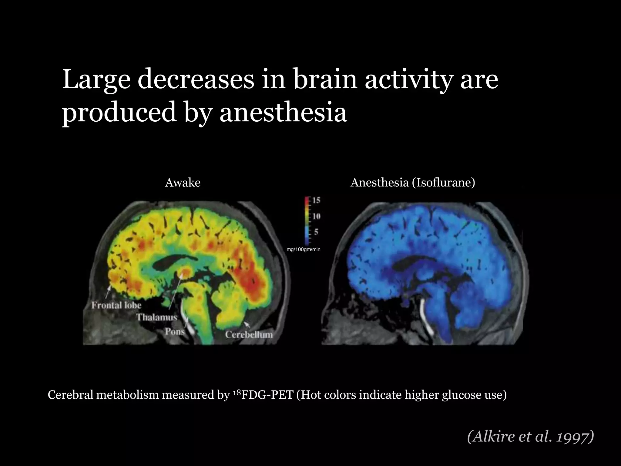 Large decreases in brain activity are
  produced by anesthesia

                    Awake                                Anesthesia (Isoflurane)




                                          mg/100gm/min




                     Awake                                              Anesthetized



Cerebral metabolism measured by 18FDG-PET (Hot colors indicate higher glucose use)


                                                                              (Alkire et al. 1997)
 