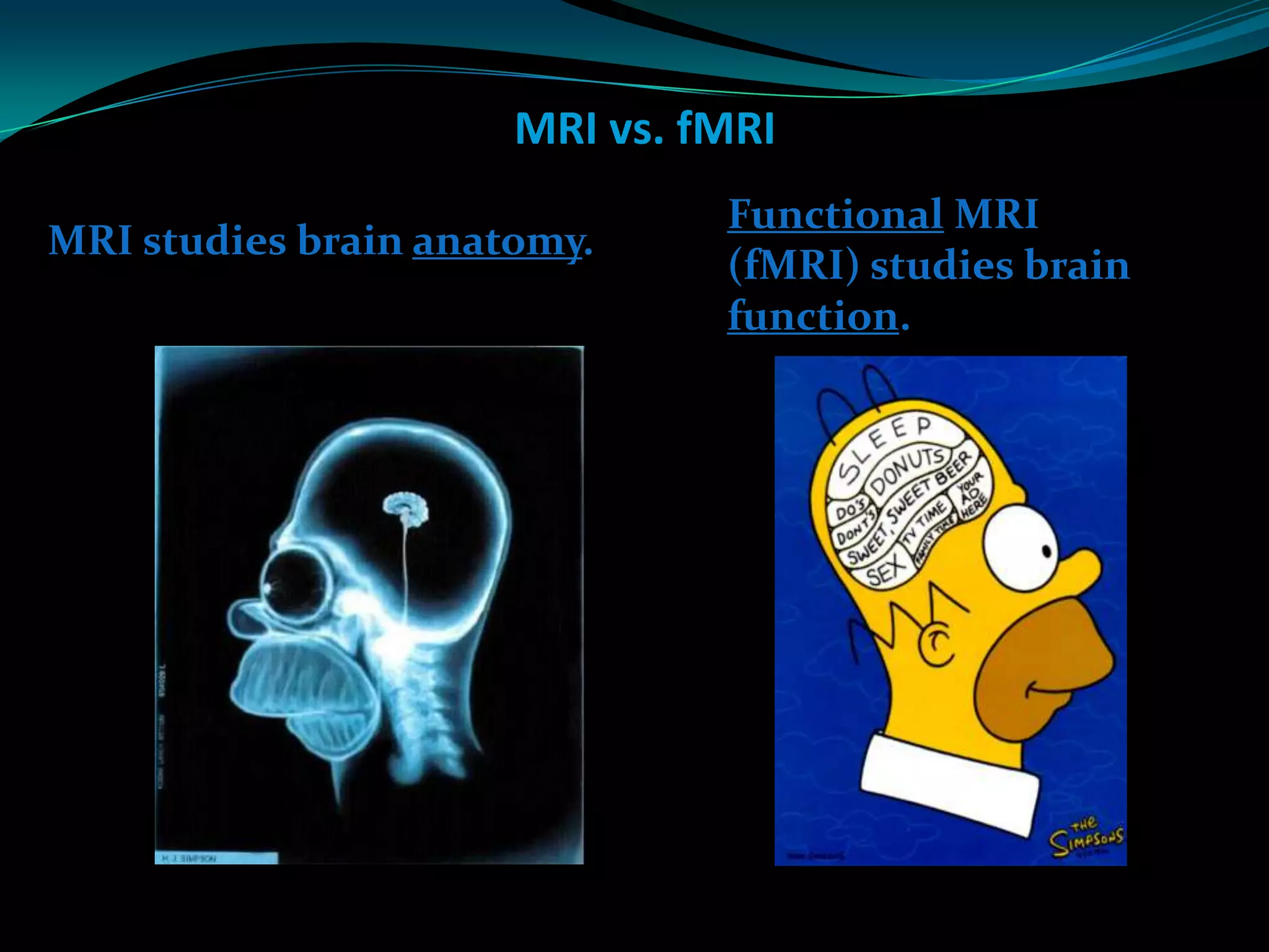 fMRI Presentation