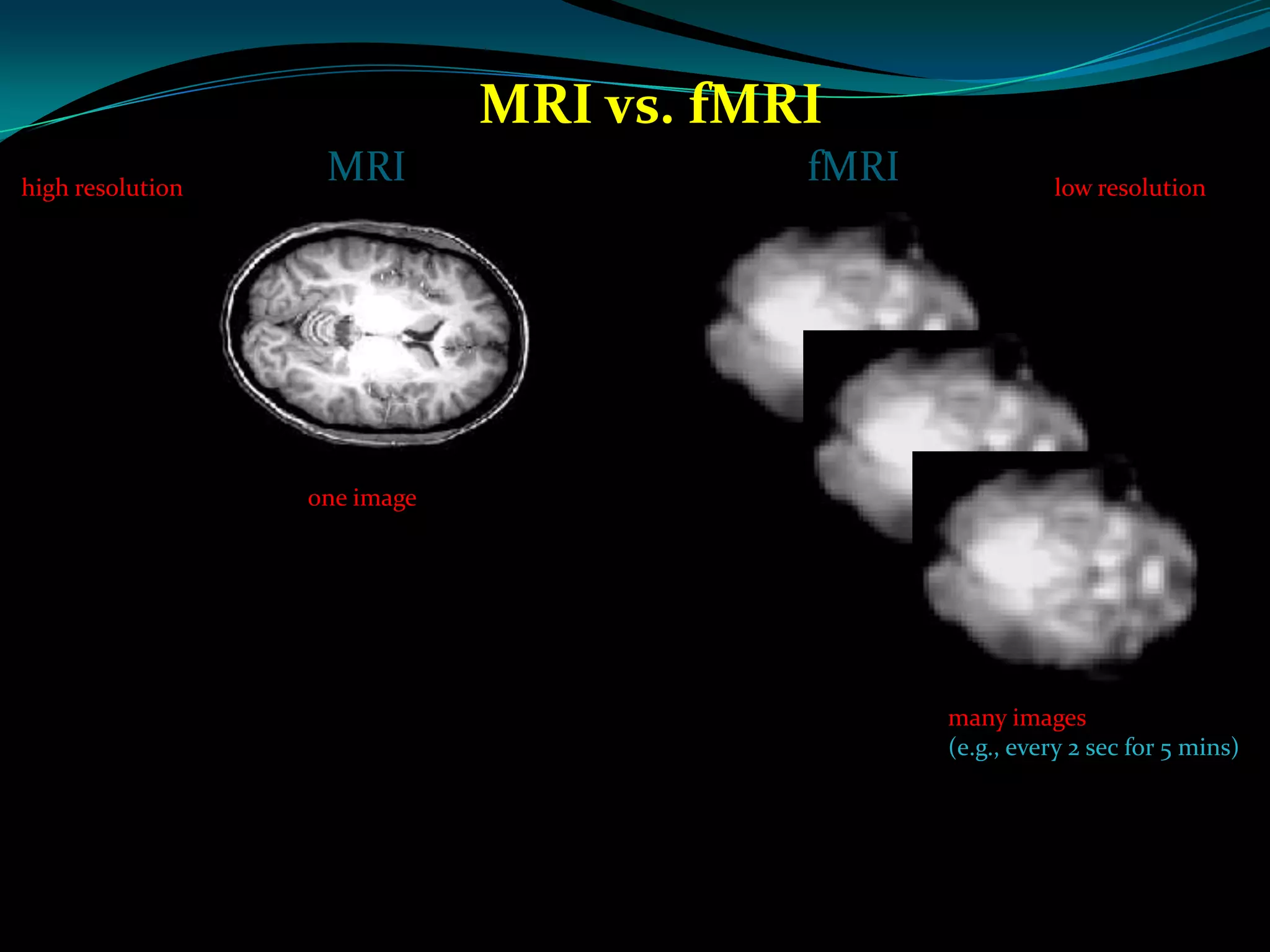 fMRI Presentation
