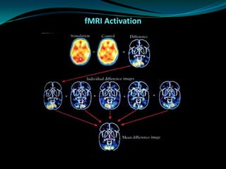 fMRI Presentation