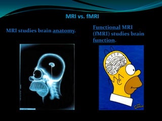 fMRI Presentation