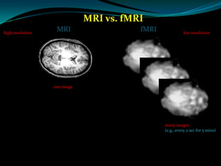 fMRI Presentation