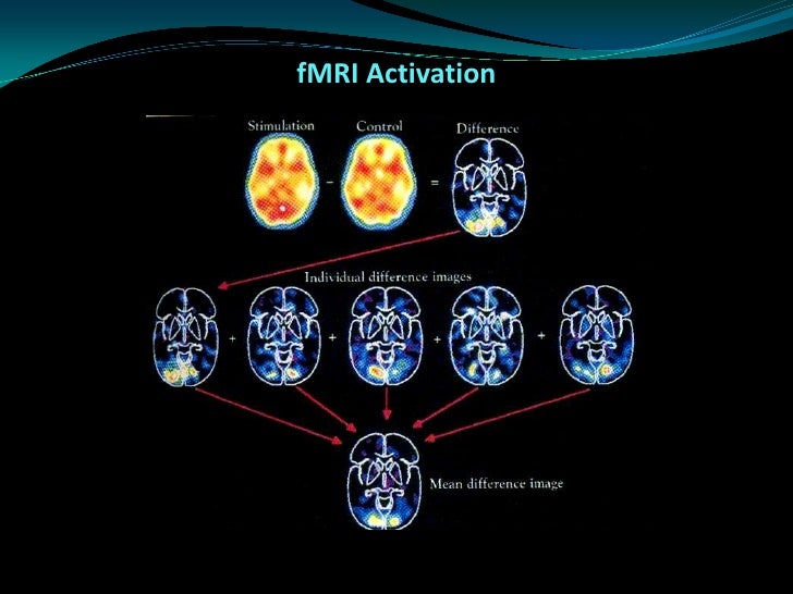 functional mri