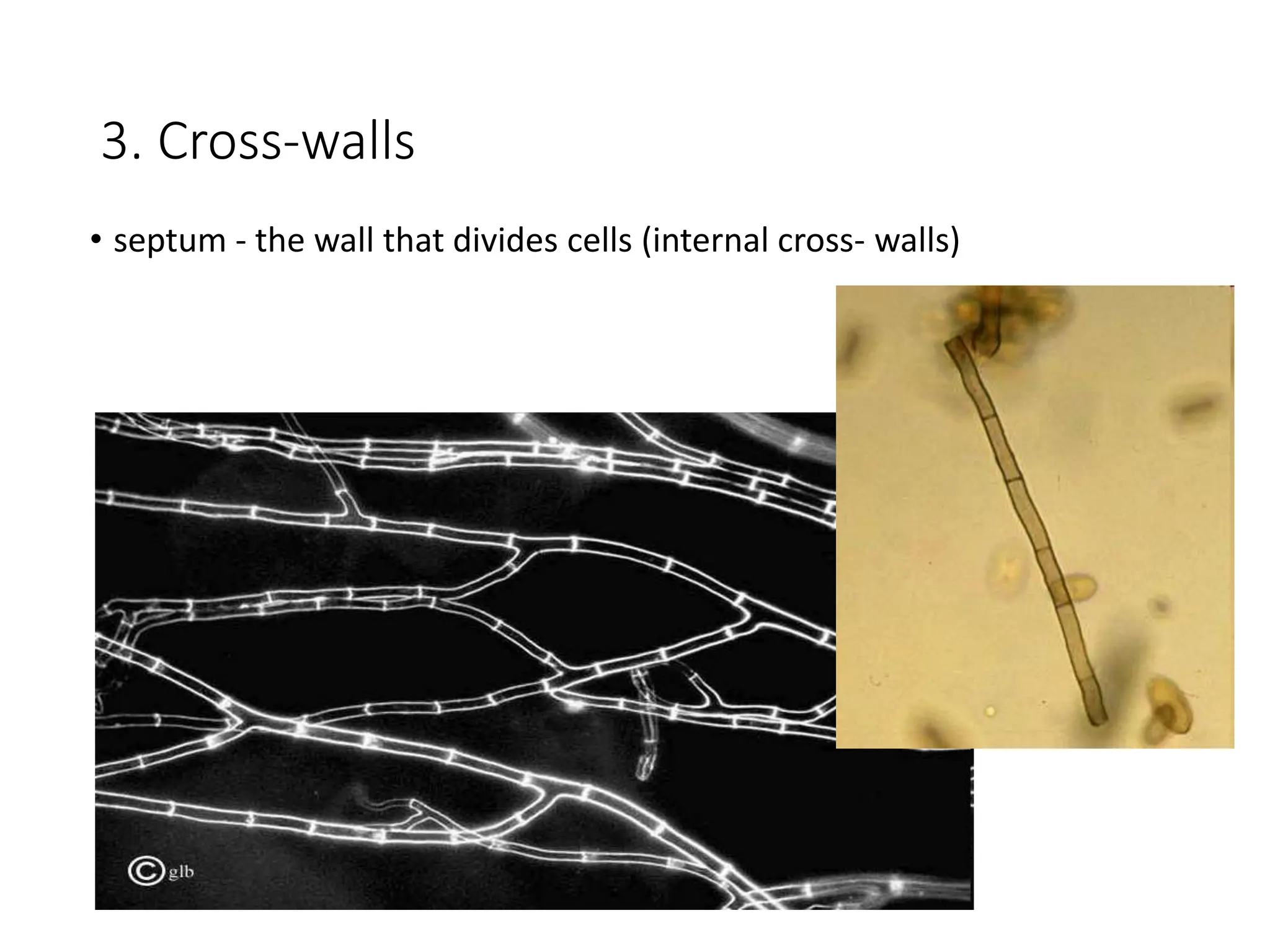 3. Cross-walls
• septum - the wall that divides cells (internal cross- walls)
 