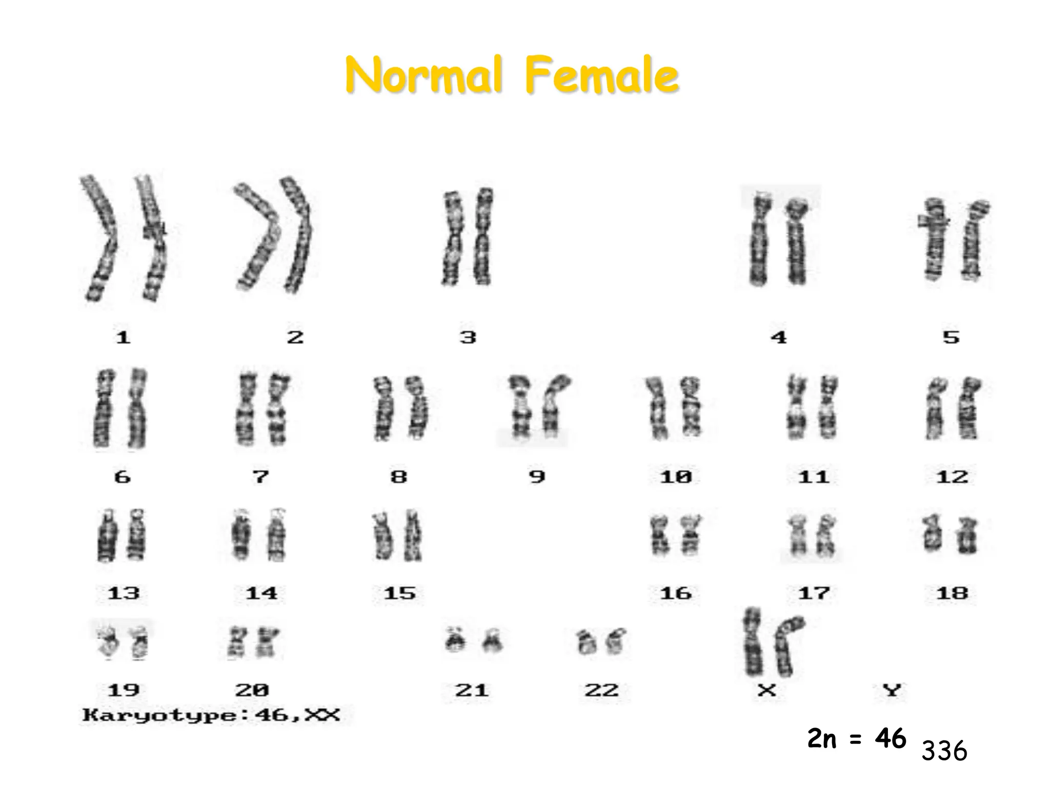 Normal Female
336
2n = 46
 