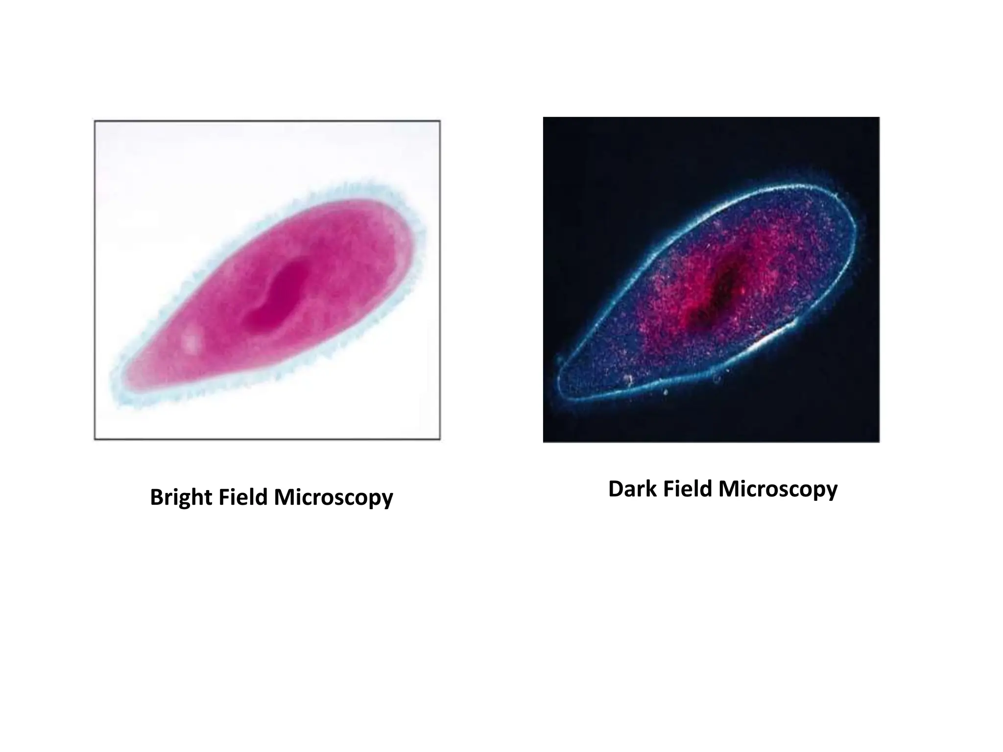 Bright Field Microscopy Dark Field Microscopy
 